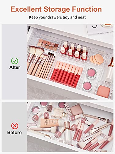 SMARTAKE 13 PCS Drawer Organizer 5-Size Desk Makeup | All Products - Image 5