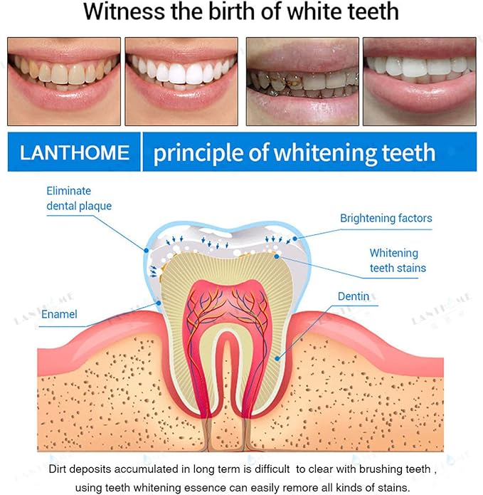 5Pcs Teeth Whitening Pen Gel Kit, Tooth Whitening Essence,Teeth Stain Remover,Intensive Stain Removal Teeth Reduce Yellowing