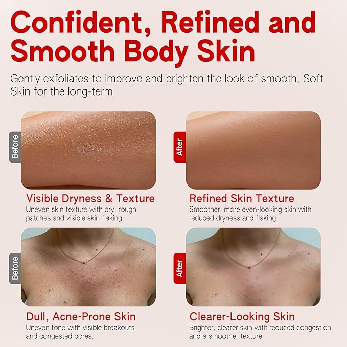 Chemical Body Exfoliator with 30% AHA & 2% BHA – Pre-Shower Body Mask for Smooth, Skin, Glycolic Acid & Salicylic Acid Formula, Body Exfoliant for Dead Skin Removal, body scrub alternative 150 ml