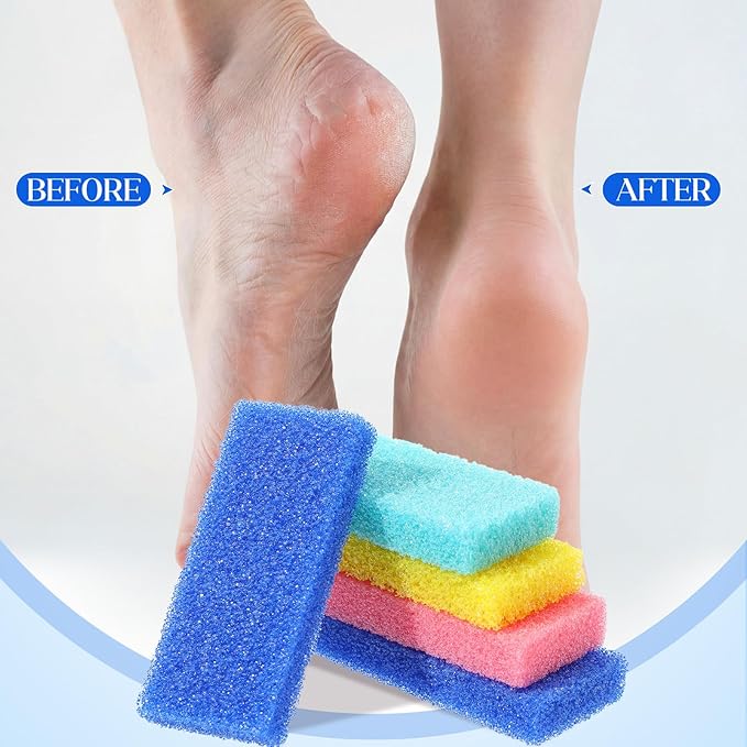 Batiyeer 300 Pcs Pumice Stone Bulk for Feet Scrubber Dead Skin Disposable Foot Pumice Foot Shower Scrubber for Heel Cuticle Callus Remover Bath Spa (Blue, Sky Blue, Pink, Yellow)